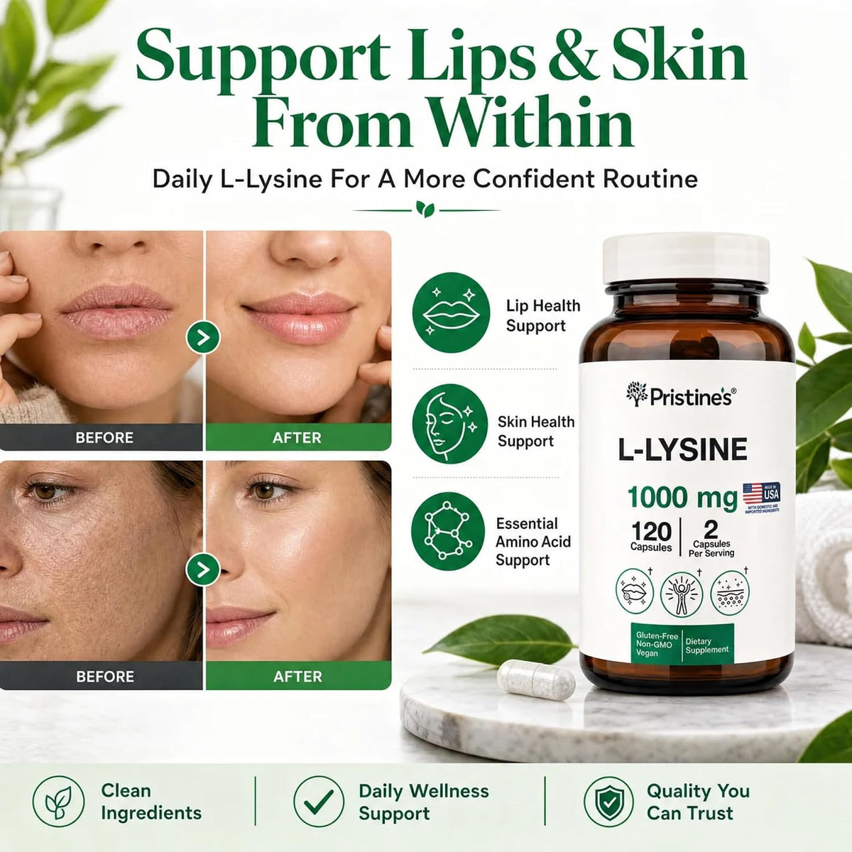 PRISTINE'S L-Lysine 1000mg Capsules, Lip Health & Immune Support, Vegan | Daily amino acid support for lip health and immune wellness. 60 day supply, vegan, non-GMO, gluten-free, glass bottle