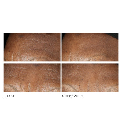 Dr Dennis Gross Advanced Retinol + Ferulic Intense Wrinkle Cream | Intensely Hydrating to Visibly Transform Skin and Repair the Moisture Barrier | 2 oz Dr Dennis GrossBuy Supplements Australia