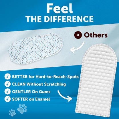 Dog Teeth Cleaning Wipes - 50 Dog Dental Care Finger Wipes - Finger Toothbrush for Removing Plaque, Tartar Buildup, Bad Breath - Oral Freshness, Healthy Teeth & Gum Support with Coconut Oil, Unscented