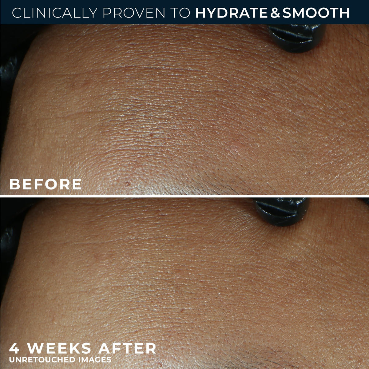 RoC Retinol Correxion Max Daily Hydration Anti-Aging Face Moisturizer with Hyaluronic Acid - PrimeBioHealth - canada supplements